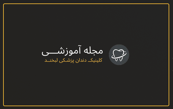 ایمپلنت دندان چیست؟ بررسی کامل مراحل، مزایا، عوارض و هزینه ایمپلنت